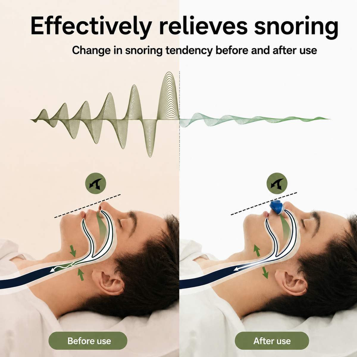 Portable CPAP anti-snoring device with accessories including charging cable and user manual
