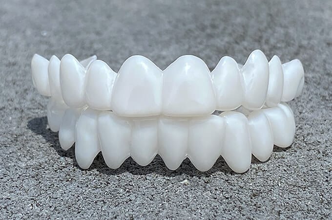 Professional Cosmetic Veneers for a Confident and Beautiful Smile