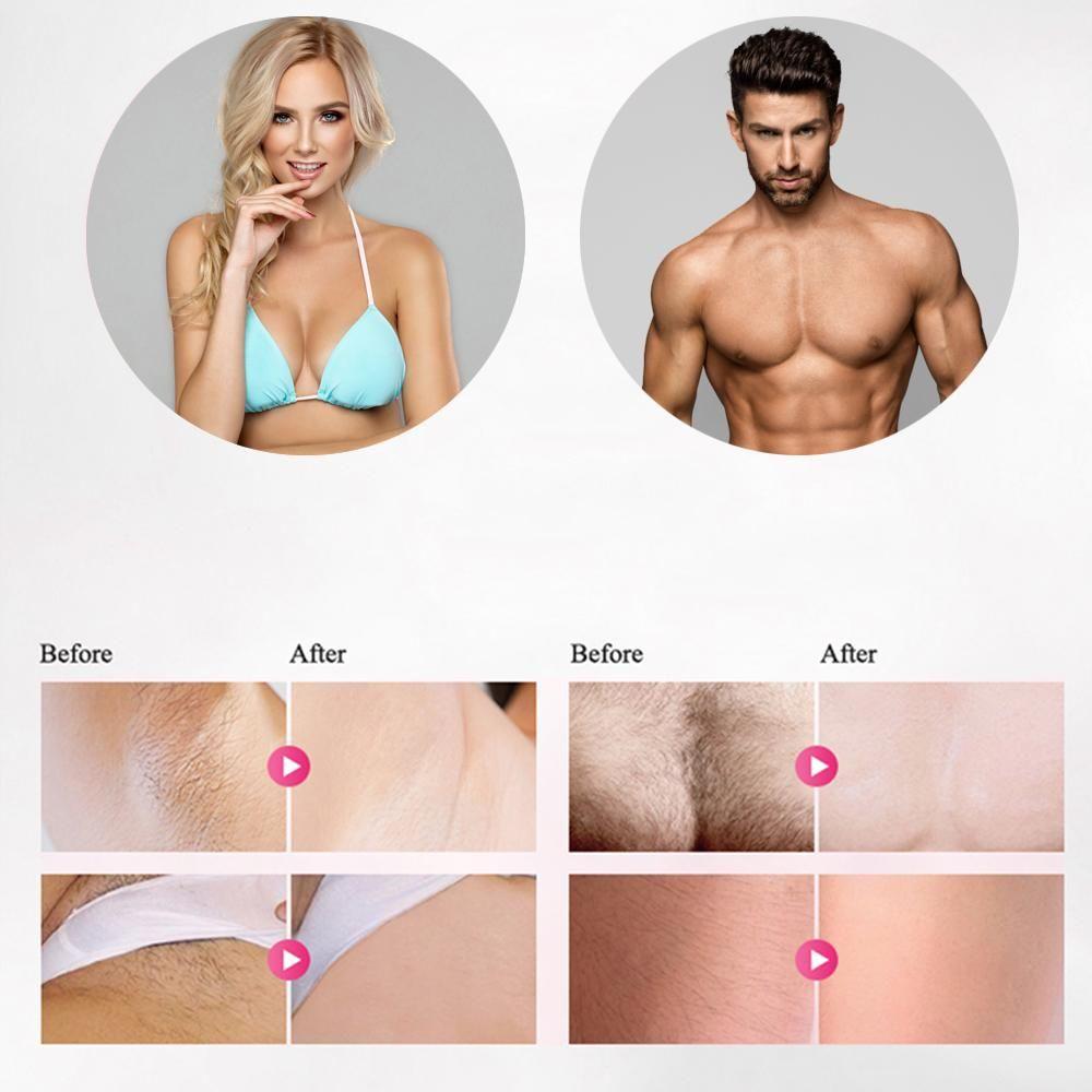 Professional IPL Laser Hair Removal Device
