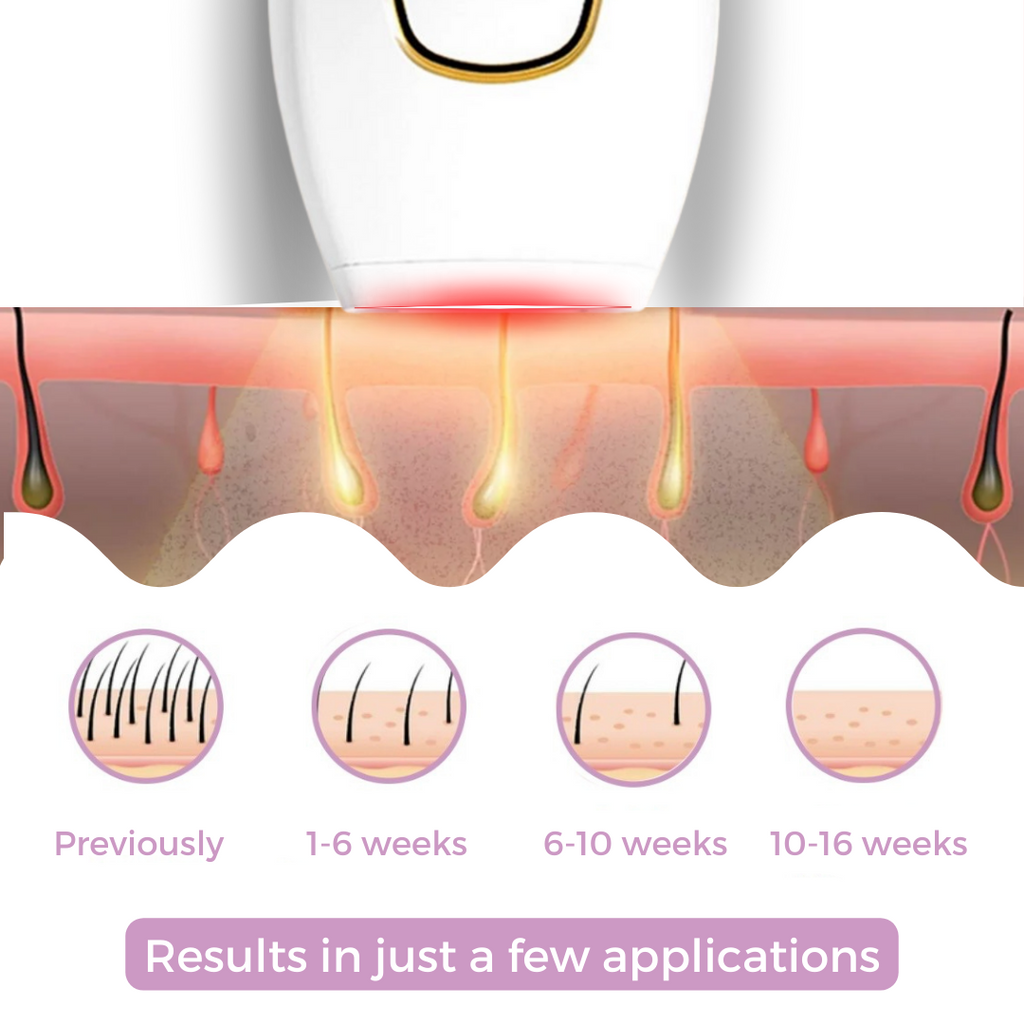 SHOPAVERLY IPL Hair Remover | The leading laser hair removal for your home